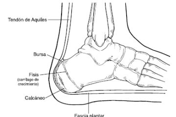 El talón de Aquiles