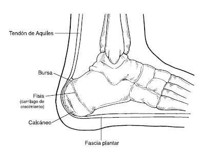 El talón de Aquiles